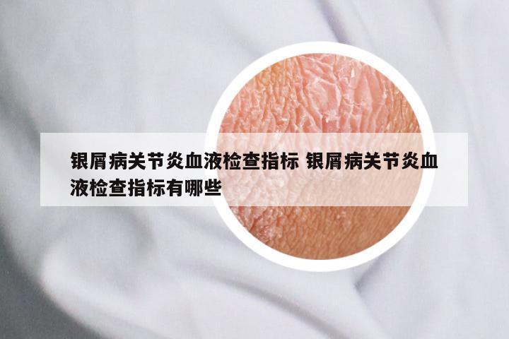 银屑病关节炎血液检查指标 银屑病关节炎血液检查指标有哪些