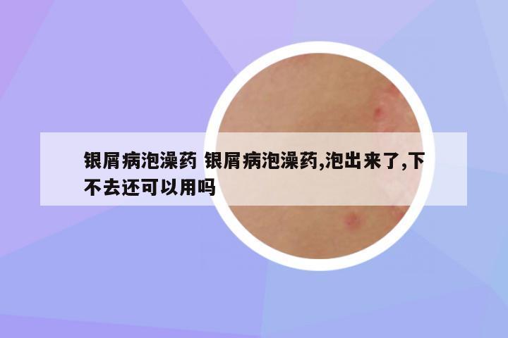 银屑病泡澡药 银屑病泡澡药,泡出来了,下不去还可以用吗