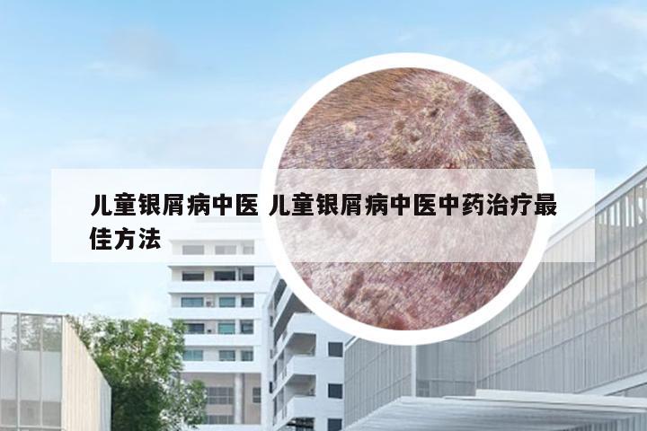 儿童银屑病中医 儿童银屑病中医中药治疗最佳方法