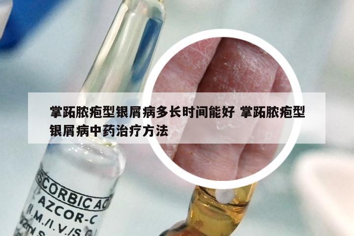 掌跖脓疱型银屑病多长时间能好 掌跖脓疱型银屑病中药治疗方法