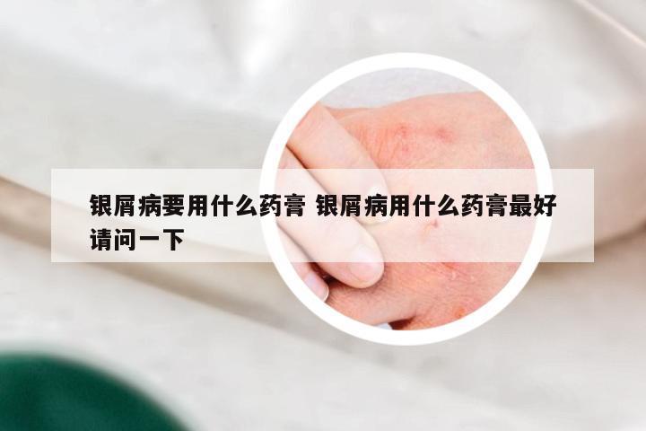 银屑病要用什么药膏 银屑病用什么药膏最好请问一下