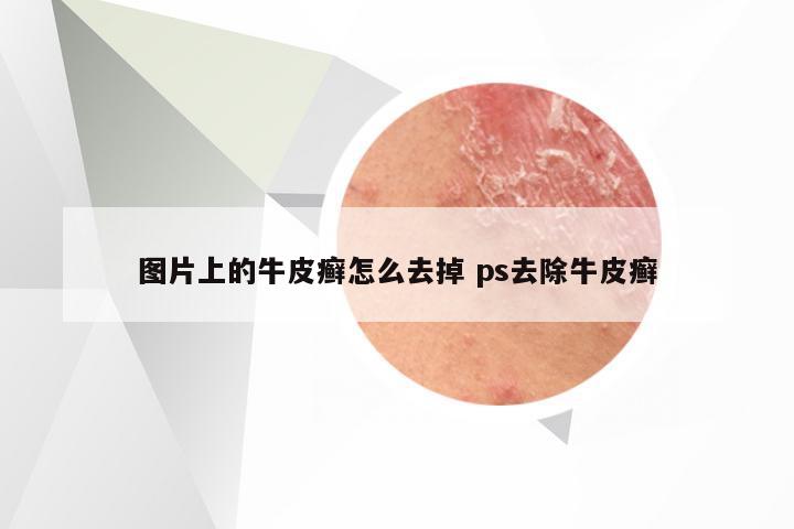 图片上的牛皮癣怎么去掉 ps去除牛皮癣