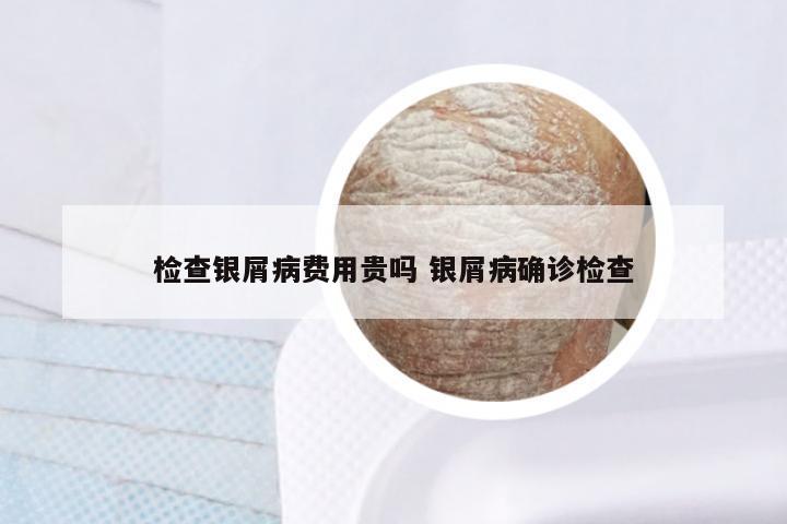 检查银屑病费用贵吗 银屑病确诊检查