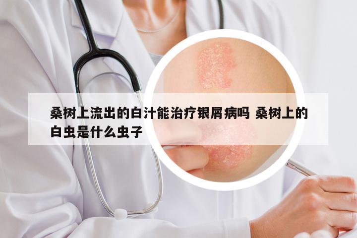桑树上流出的白汁能治疗银屑病吗 桑树上的白虫是什么虫子