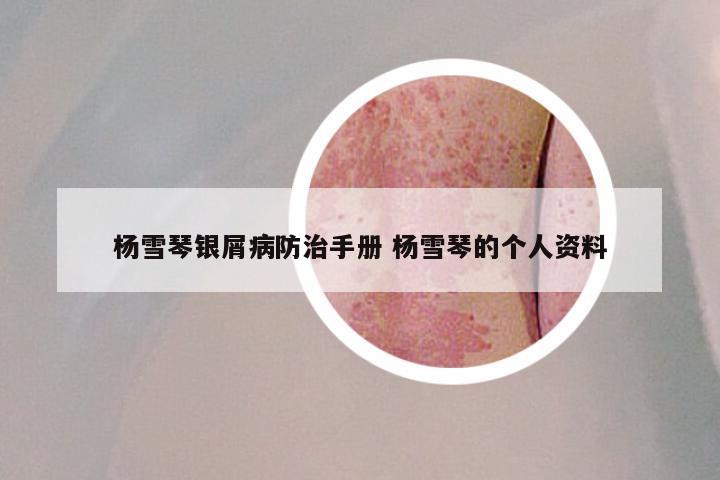 杨雪琴银屑病防治手册 杨雪琴的个人资料