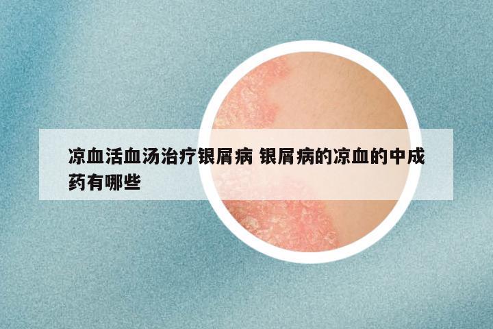 凉血活血汤治疗银屑病 银屑病的凉血的中成药有哪些