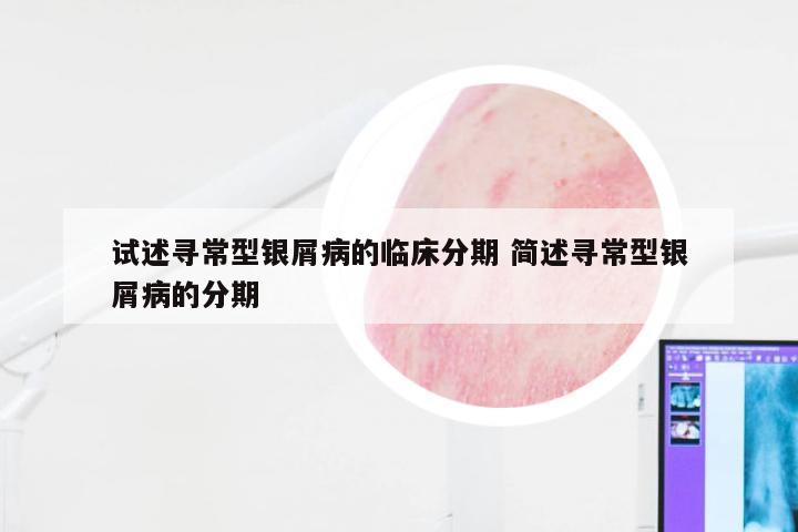 试述寻常型银屑病的临床分期 简述寻常型银屑病的分期