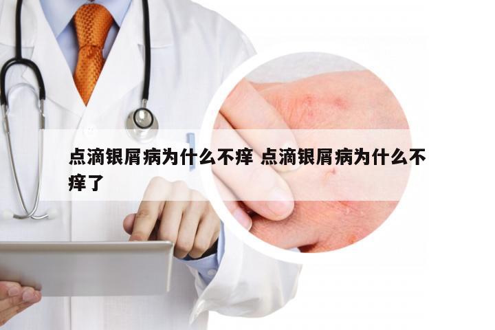点滴银屑病为什么不痒 点滴银屑病为什么不痒了