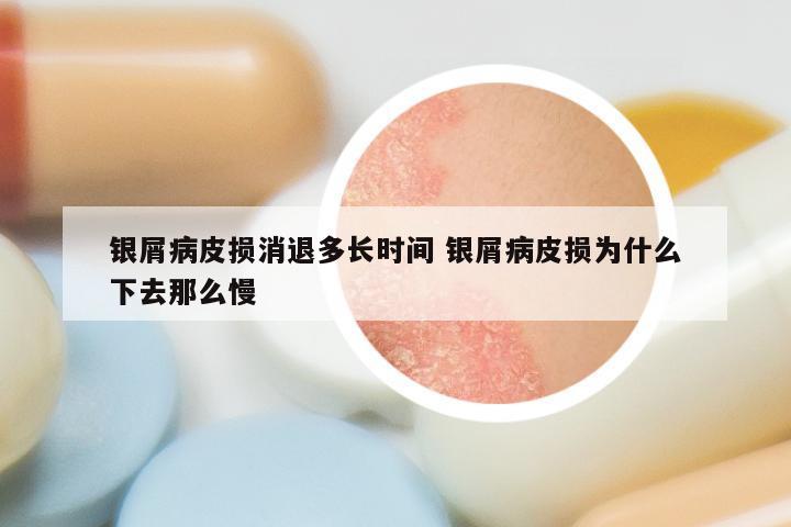 银屑病皮损消退多长时间 银屑病皮损为什么下去那么慢