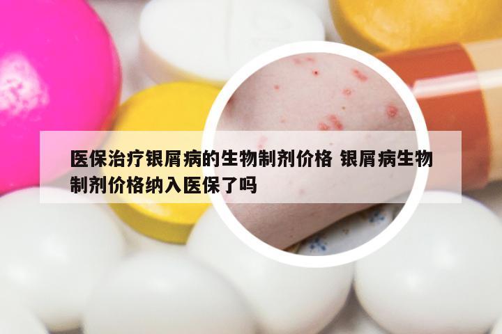 医保治疗银屑病的生物制剂价格 银屑病生物制剂价格纳入医保了吗
