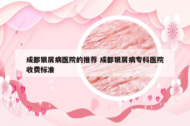 成都银屑病医院的推荐 成都银屑病专科医院收费标准