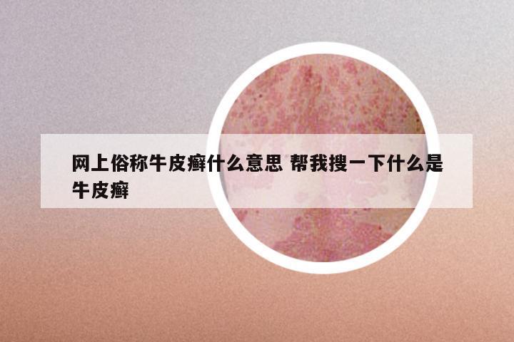 网上俗称牛皮癣什么意思 帮我搜一下什么是牛皮癣