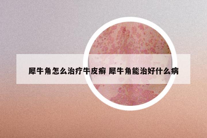 犀牛角怎么治疗牛皮癣 犀牛角能治好什么病