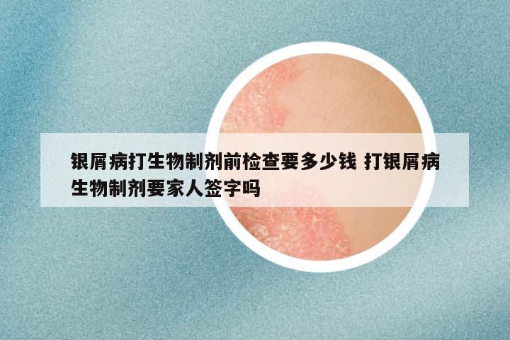 银屑病打生物制剂前检查要多少钱 打银屑病生物制剂要家人签字吗