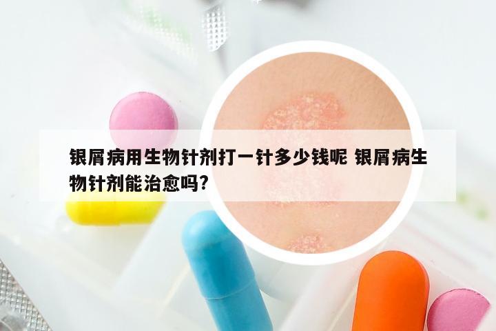 银屑病用生物针剂打一针多少钱呢 银屑病生物针剂能治愈吗?