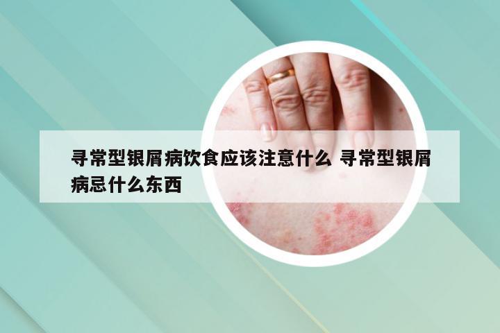 寻常型银屑病饮食应该注意什么 寻常型银屑病忌什么东西