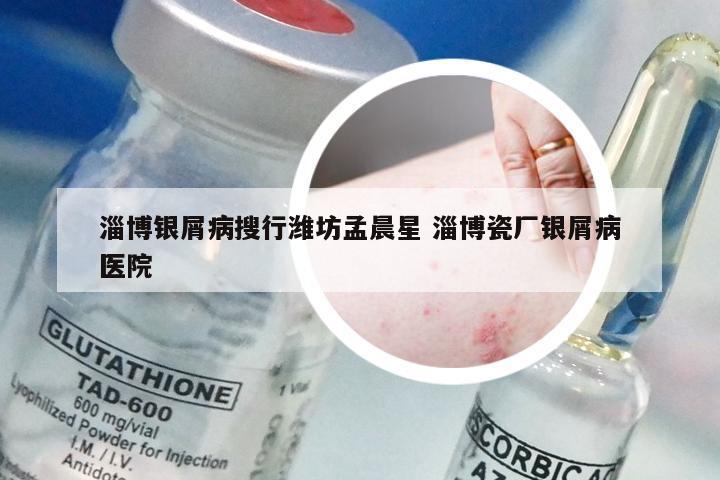 淄博银屑病搜行潍坊孟晨星 淄博瓷厂银屑病医院