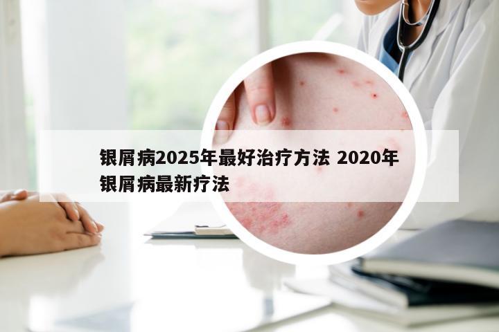 银屑病2025年最好治疗方法 2020年银屑病最新疗法