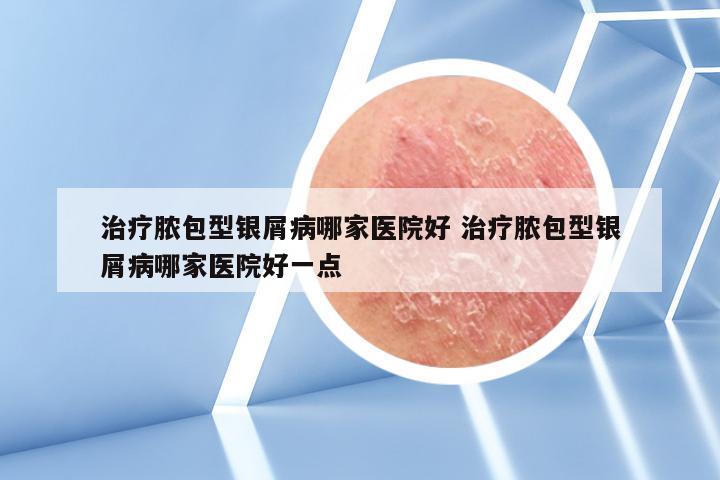 治疗脓包型银屑病哪家医院好 治疗脓包型银屑病哪家医院好一点