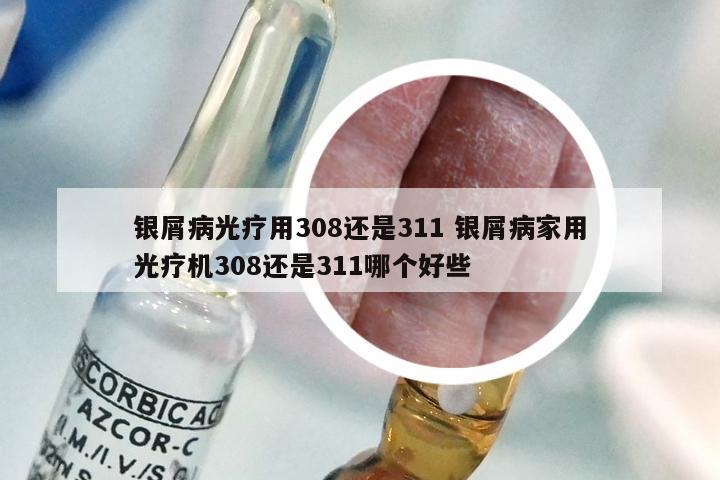 银屑病光疗用308还是311 银屑病家用光疗机308还是311哪个好些