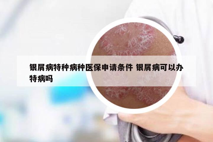 银屑病特种病种医保申请条件 银屑病可以办特病吗