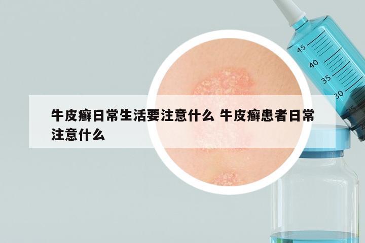 牛皮癣日常生活要注意什么 牛皮癣患者日常注意什么