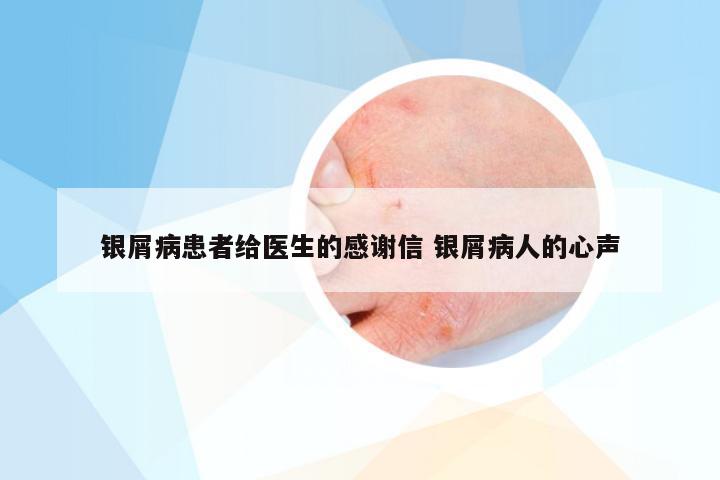 银屑病患者给医生的感谢信 银屑病人的心声