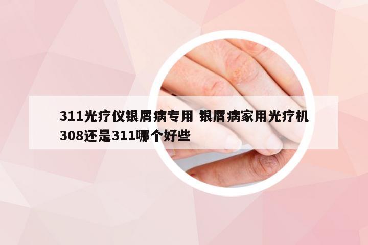 311光疗仪银屑病专用 银屑病家用光疗机308还是311哪个好些