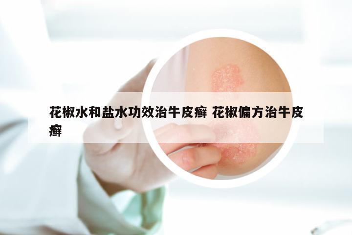 花椒水和盐水功效治牛皮癣 花椒偏方治牛皮癣