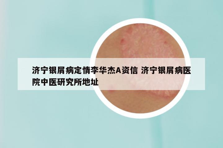 济宁银屑病定情李华杰A资信 济宁银屑病医院中医研究所地址