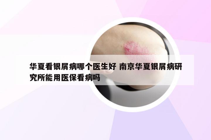 华夏看银屑病哪个医生好 南京华夏银屑病研究所能用医保看病吗
