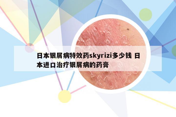 日本银屑病特效药skyrizi多少钱 日本进口治疗银屑病的药膏