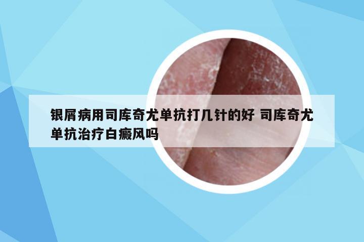 银屑病用司库奇尤单抗打几针的好 司库奇尤单抗治疗白癜风吗
