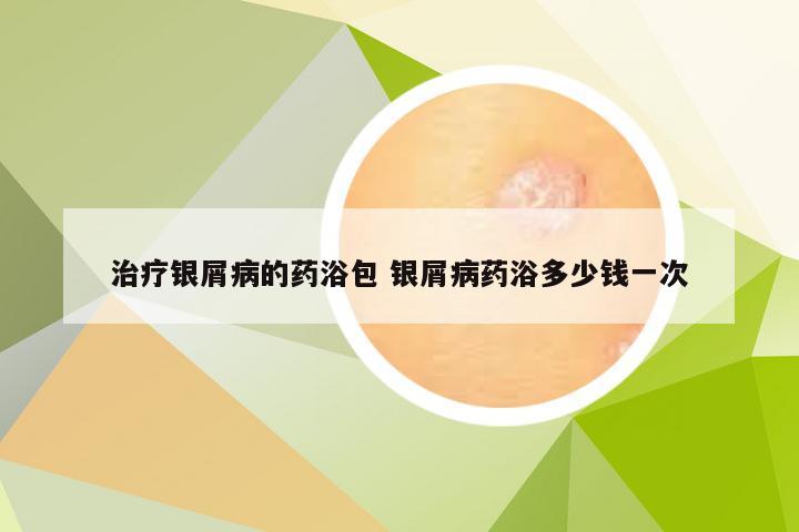 治疗银屑病的药浴包 银屑病药浴多少钱一次