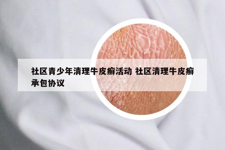 社区青少年清理牛皮癣活动 社区清理牛皮癣承包协议