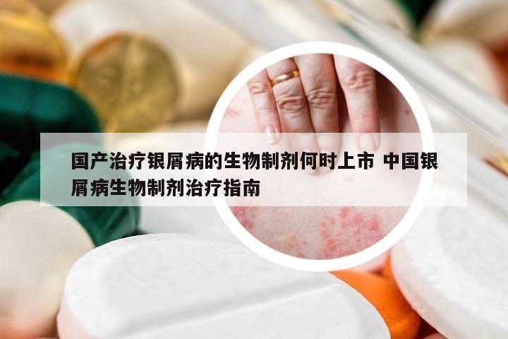 国产治疗银屑病的生物制剂何时上市 中国银屑病生物制剂治疗指南