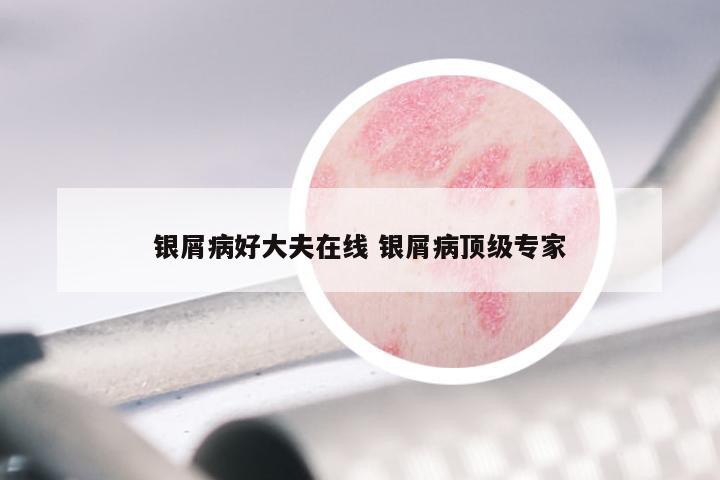银屑病好大夫在线 银屑病顶级专家