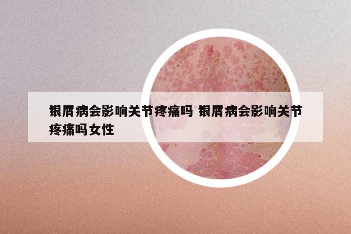 银屑病会影响关节疼痛吗 银屑病会影响关节疼痛吗女性