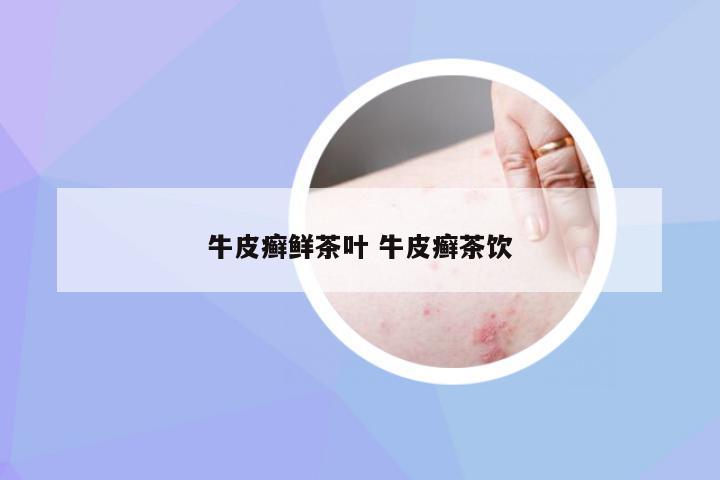 牛皮癣鲜茶叶 牛皮癣茶饮