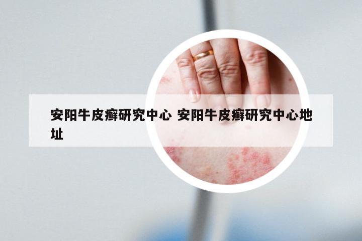 安阳牛皮癣研究中心 安阳牛皮癣研究中心地址