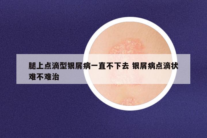 腿上点滴型银屑病一直不下去 银屑病点滴状难不难治
