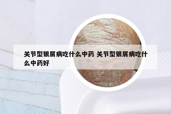 关节型银屑病吃什么中药 关节型银屑病吃什么中药好