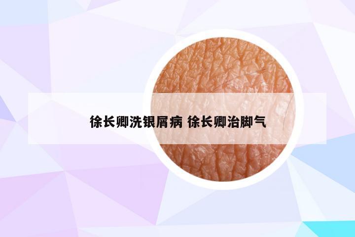 徐长卿洗银屑病 徐长卿治脚气