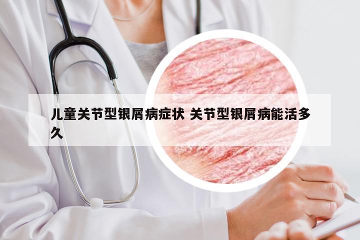 儿童关节型银屑病症状 关节型银屑病能活多久