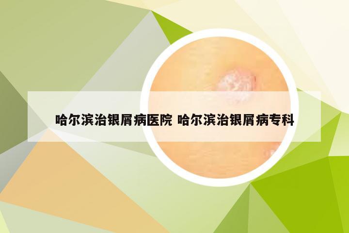 哈尔滨治银屑病医院 哈尔滨治银屑病专科