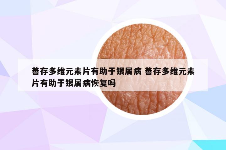 善存多维元素片有助于银屑病 善存多维元素片有助于银屑病恢复吗