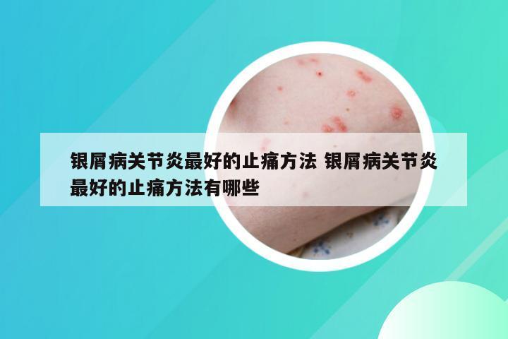 银屑病关节炎最好的止痛方法 银屑病关节炎最好的止痛方法有哪些