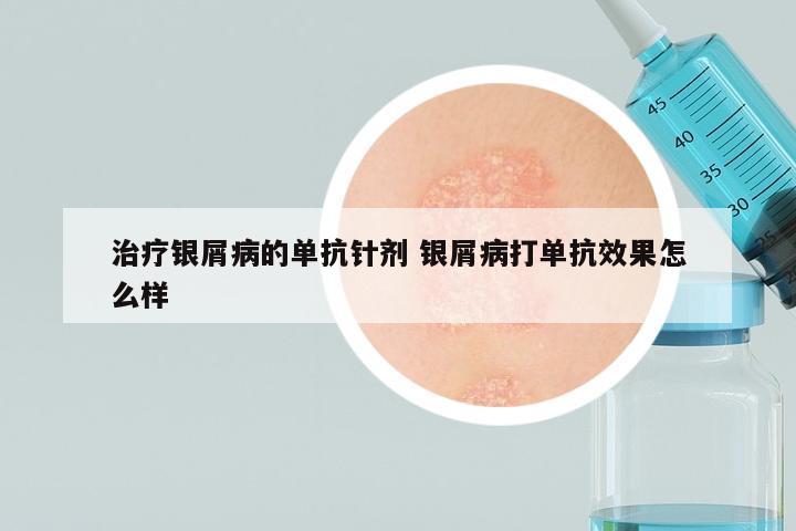 治疗银屑病的单抗针剂 银屑病打单抗效果怎么样