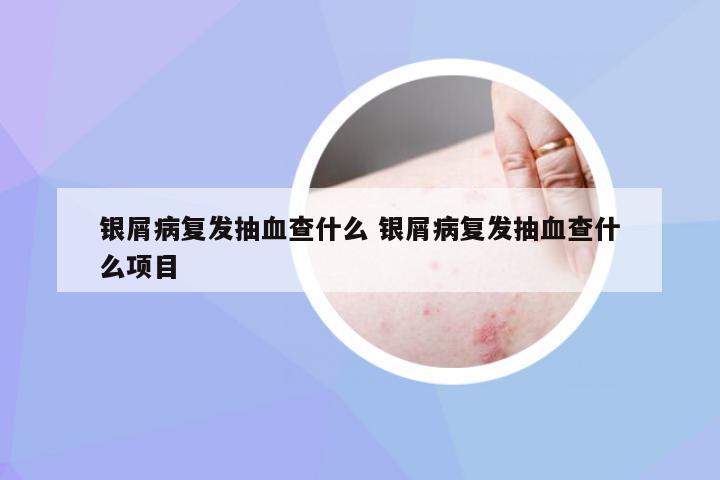银屑病复发抽血查什么 银屑病复发抽血查什么项目