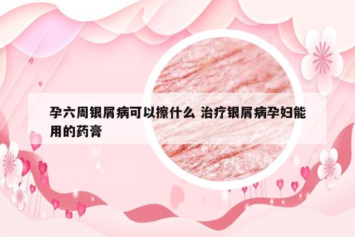 孕六周银屑病可以擦什么 治疗银屑病孕妇能用的药膏